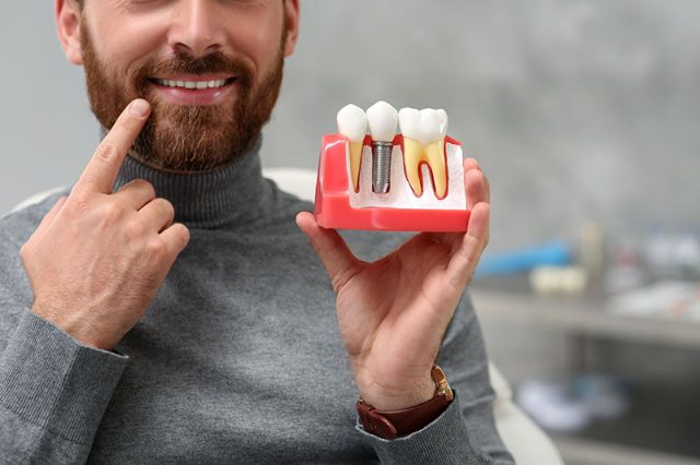 Man smiling and pointing at dental implants model, showcasing the benefits of dental implants for restoring smiles.