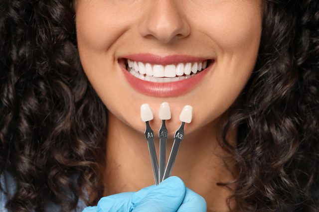 Smiling woman showcasing porcelain veneer color samples labeled A1, A2, and A3, emphasizing cosmetic dentistry solutions for smile enhancement.