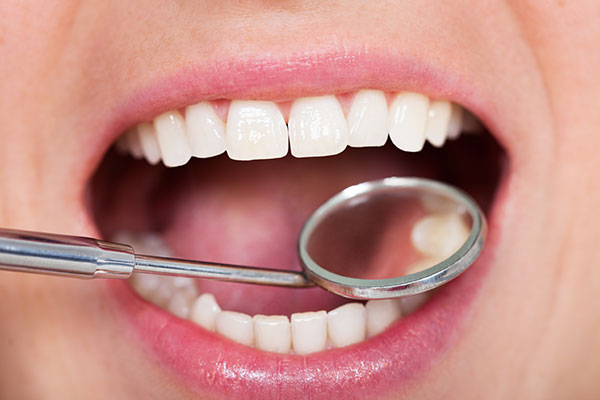 Close-up of a person's mouth with bright, healthy teeth, showcasing a dental mirror and explorer, emphasizing dental care and cosmetic dentistry resolutions for 2026.